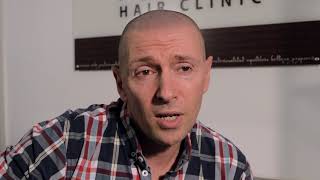 Lee Talks about his recent Micro Scalp Pigmentation Treatment [upl. by Justina]