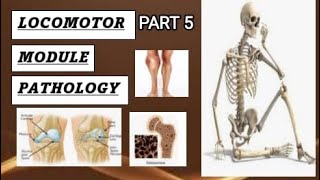 Loco pathology  metabolic disease  hyperparathyroidism locomotor pathology hyperparathyroidism [upl. by Anuala]