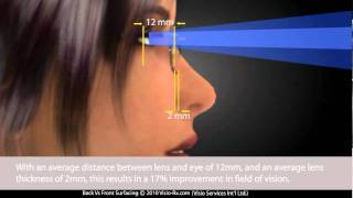 Progressive Lenses Back Surfacing vs Front Surfacing Digital Freeform Glasses technology [upl. by Meilen574]