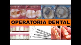 quotOPERATORIA DENTALquot por la Dra Lourdes Mejía 2 [upl. by Madelin886]