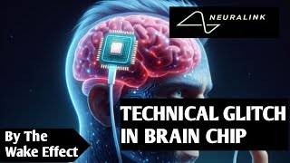 Elon Musks Neuralink Had a Brain Implant Setback Is it safe [upl. by Vally]