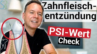 Zahnfleischentzündung  Was ist der PSIWert [upl. by Ilrebmyk]