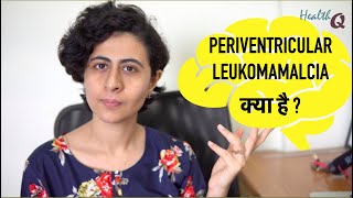 PERIVENTRICULAR LEUKOMALACIA KYA HAI [upl. by Fifi]