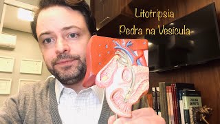 Litotripsia para Pedra na Vesícula [upl. by Haram]