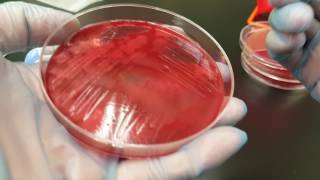 Microbiology Clostridium perfringens biochemical testing and colonial growth [upl. by Okimat945]