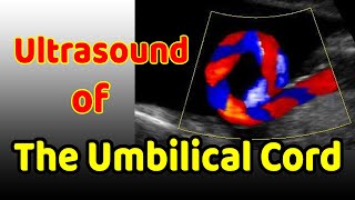 Ultrasound of the Umbilical Cord [upl. by Laband883]