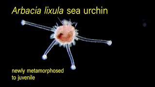 Arbacia lixula sea urchin newly metamorphosed to juvenile [upl. by Billen328]