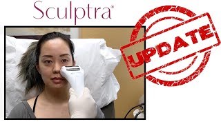 SCULPTRA UPDATE  SEREIN WU [upl. by Ethelstan47]