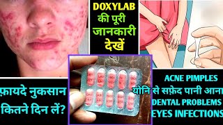 Doxylab Capsules Uses in Hindi  Doxycycline and Ambroxol Capsule Uses in Hindi [upl. by Bolten]