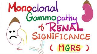 Monoclonal Gammopathy of Renal Significance MGRS  Plasma Cell Disorder  Hematology  Oncology [upl. by Kristian]