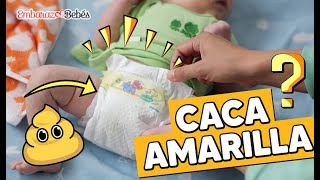 💩🟡 ¿Qué causa la CACA AMARILLA en Bebés ¿Son normales [upl. by Marjana]