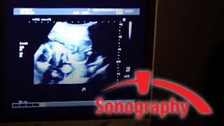 SONO – Sonography  BRCC [upl. by Bennir]