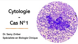 🔬Cytologie  Anomalies Morphologiques dans le Frottis Sanguin et le Myélogramme 🔬 [upl. by Nnaycnan470]