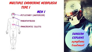 Multiple Endocrine Neoplasia Type I MENI [upl. by Sinclair179]