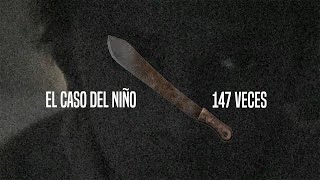 El Caso Del Niño Mutilado 147 VECES [upl. by Aleemaj888]