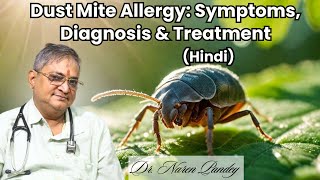 Dust Mite Allergy Symptoms Diagnosis amp TreatmentHindi Dr Naren Pandey  Allergy Asthma Centre [upl. by Herwin]