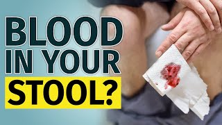 BLOOD IN STOOL  Other Signs You Have to Check [upl. by Eastlake386]