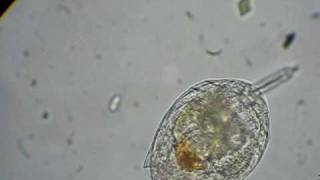 rotifer feeding on algae [upl. by Airbas]