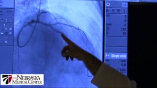 Coronary Stents  The Nebraska Medical Center [upl. by Lrub]