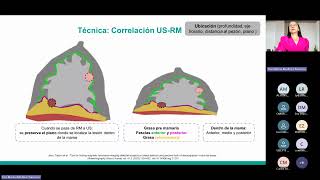 Ecografía mamaria [upl. by Euqinehs462]
