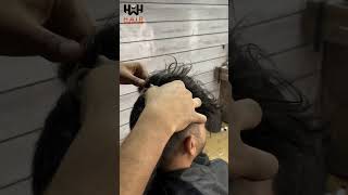 Hair Clip Method  Hair patch For men [upl. by Ebeohp]