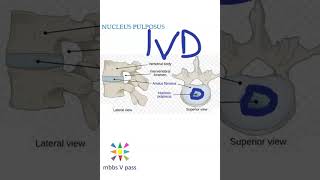 Anatomy Thorax 218 Nucleus Pulposus InterVertebral disc prolapse viva [upl. by Niak]