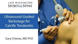 Ultrasoundguided Barbotage for Calcific Tendinitis [upl. by Ocin852]