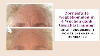 Zornesfalte in 4 Wochen wegbekommen Dank GesichtstrainingsKurs VorherNachher [upl. by Earesed716]