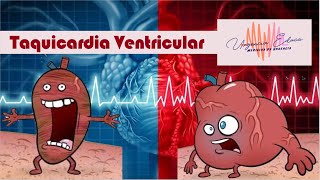 Taquicardia Ventricular Taquiarritmia de QRS Ancho y Regular [upl. by Grearson365]