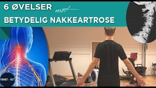 6 Øvelser mot Betydelig Nakkeartrose [upl. by Jorgenson551]