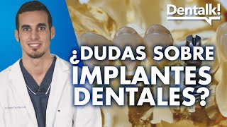 Todo sobre IMPLANTES DENTALES precio duración complicaciones y otras dudas comunes  Dentalk ©️ [upl. by Moscow]