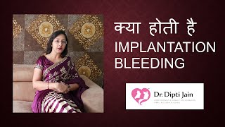 Implantation Bleeding me Smell ati hai Kya।Implantation Bleeding Vs Periods in Hindi।Pregnancy Tips [upl. by Tara]