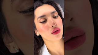 Вторичная контурная пластика губ 💉 Stylage M  0 8 ml 👄 filler косметология [upl. by Ahsimet]