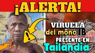 ALERTA ⚠️ TAILANDIA CONFIRMA VARIANTE LETAL DE VIRUELA DEL MONO EN SU TERRITORIO [upl. by Kenay]