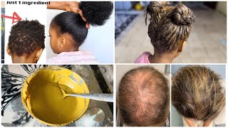 Nafaqo ama maska timaha bixya daadhsho ka ilaalinayo hair growth mask [upl. by Pinelli]