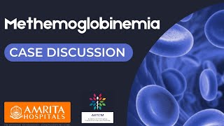 Methemoglobinemia  Case Discussion [upl. by Marthena]