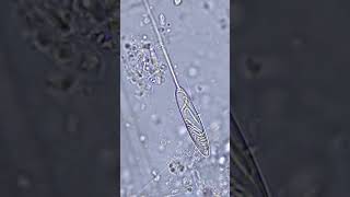 Microscopia de cnidócitos ou cnidoblastos de um cnidário [upl. by Lucky627]