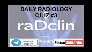 DAILY RADIOLOGY QUIZ DISCUSSION3 [upl. by Ssecnirp466]