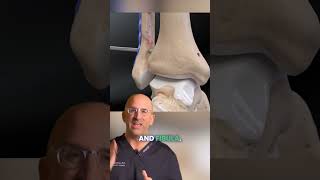 Anchoring High Ankle Sprain for Stability shorts [upl. by Haimerej]