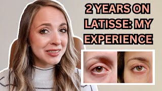 2 YEARS USING LATISSE MY RESULTS  Any Negative Side Effects Is It Worth The Money [upl. by Ecirtal]