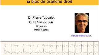 4g Bloc de branche droit 3 ischémie aiguë et infarctus P Taboulet [upl. by Krug24]