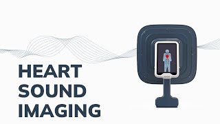 Beating heart sound visualization  Sorama Acoustic Camera [upl. by Dugaid]