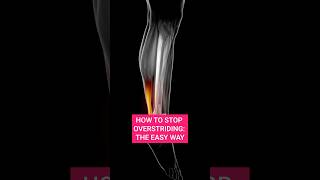 HOW TO STOP OVERSTRIDING THE EASY WAY [upl. by Reace]