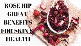 Incredible Skin amp Health Benefits of Rosehip Tea [upl. by Oicnaneb718]