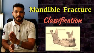 Mandible Fracture Classification [upl. by Sherris712]