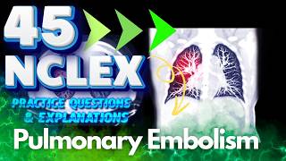 NCLEX RN 45 Pulmonary Embolism Practice Questions amp Answers  Essential Nursing Knowledge [upl. by Nyrrek297]