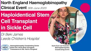 Haplo Stem Cell Transplants in Sickle Cell N England Haemoglobinopathy Clinical Event 300623 [upl. by Ikkaj953]