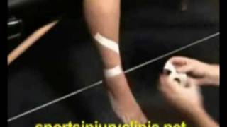 Taping technique for shin splints [upl. by Rauscher]