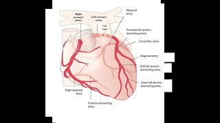 RESTRICTIVE CARDIOMYOPATHY [upl. by Berkly]