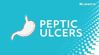 Peptic Ulcers  NCLEX RN Review [upl. by Anurb624]